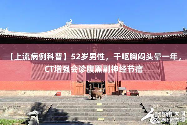 【上流病例科普】52岁男性，干呕胸闷头晕一年，CT增强会诊腹黑副神经节瘤